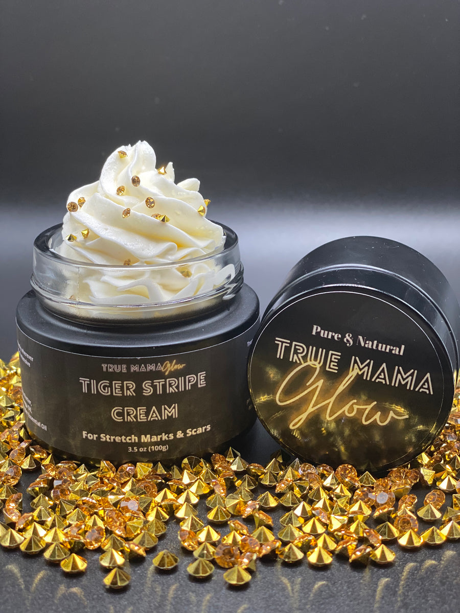Tiger Stripe Stretch Mark & Scar Cream